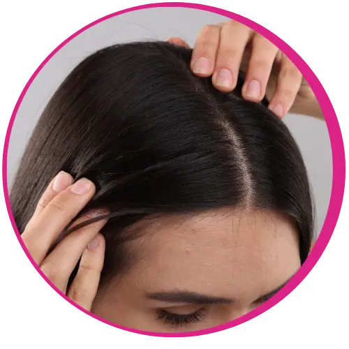 Reverte a Queda Capilar